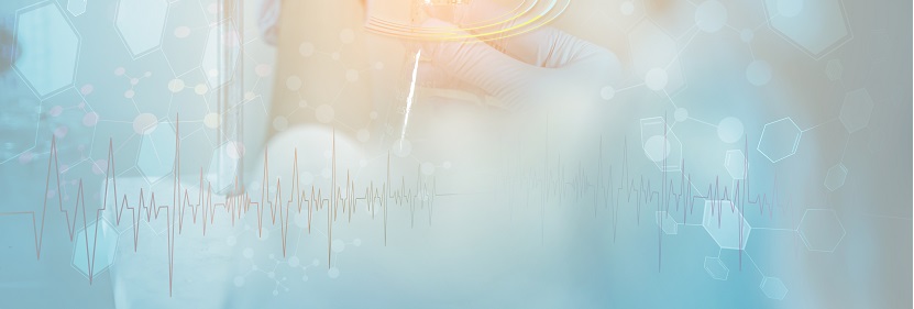 三聚氰胺改性脲醛樹(shù)脂檢測(cè)