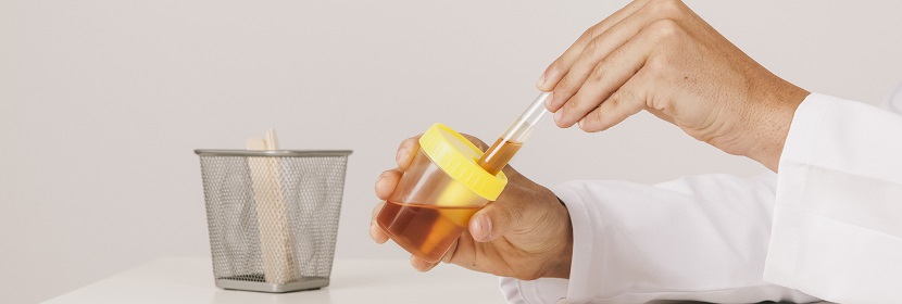 尿素水溶液（AUS 32）檢測(cè)